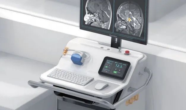 First Successful Laser Interstitial Thermal Therapy (LITT) for Drug-Resistant Epilepsy at Beijing Tiantan Puhua Hospital