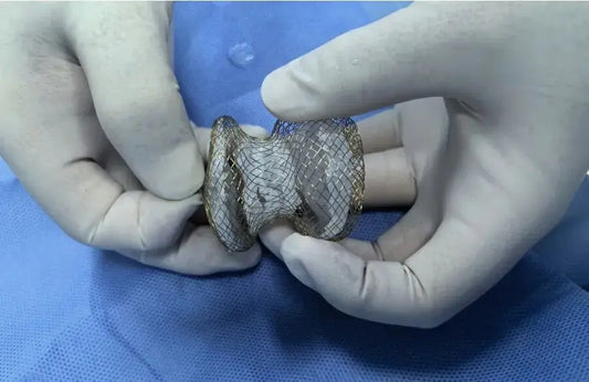 Technical Standards | Fuwai Hospital's Liu Yuhao Team Achieves Interventional Closure of Giant 35mm PDA via 3D Printing Technology